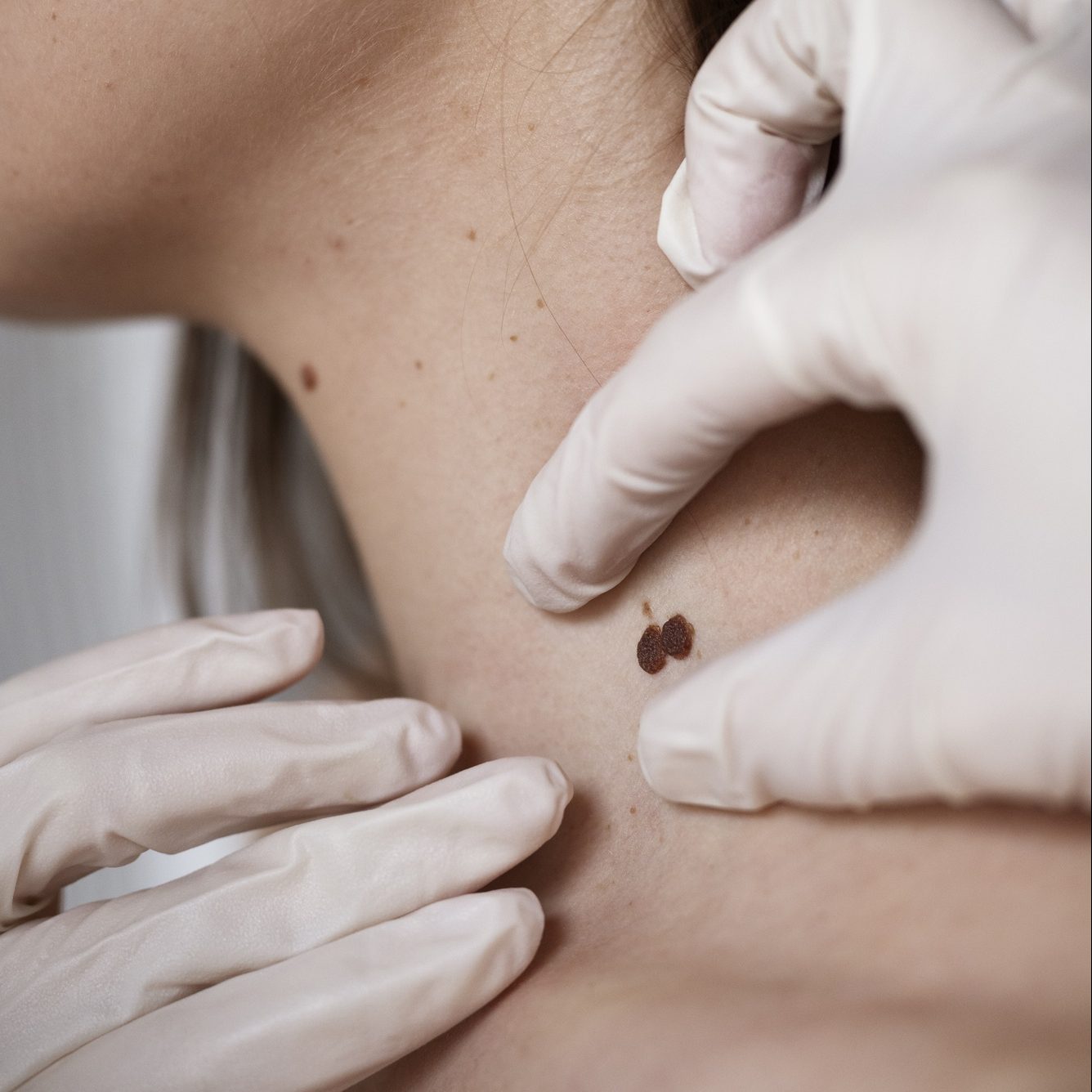 برداشت خال در تهران