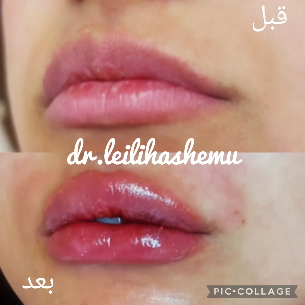 ژل لب مدل قلوه ای