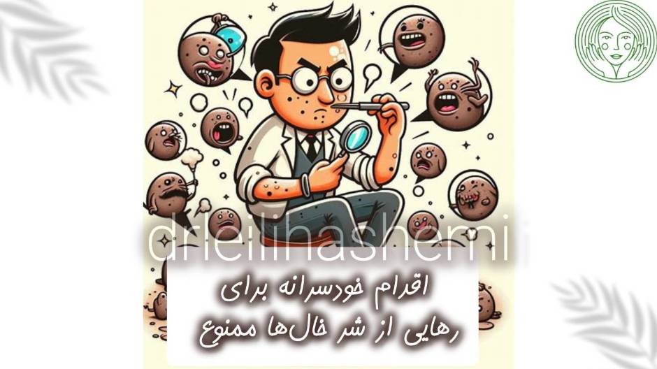 برداشتن خال باید توسط دکتر انجام شود