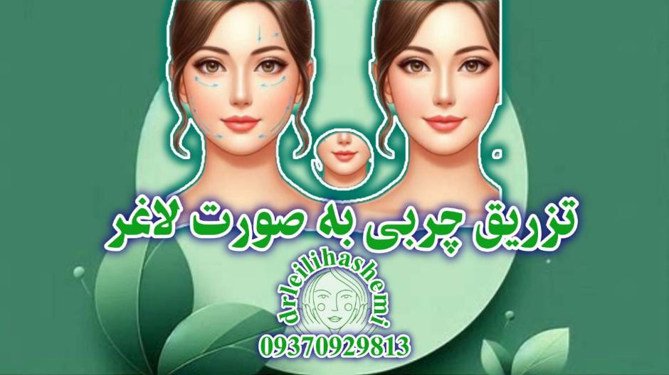 تزریق چربی به صورت لاغر