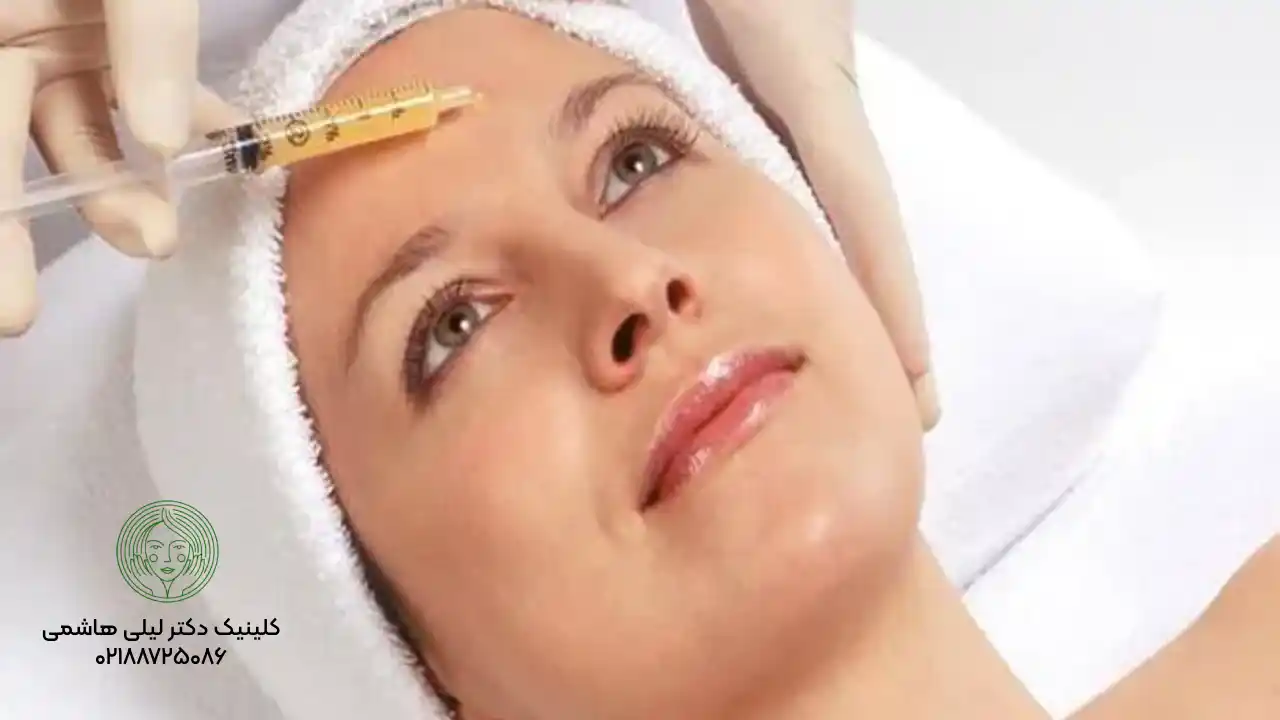 ماندگاری نانوفت چقدر است؟