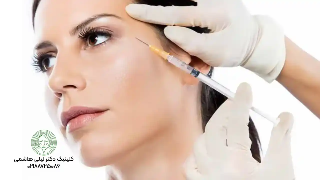 نانوفت چیست