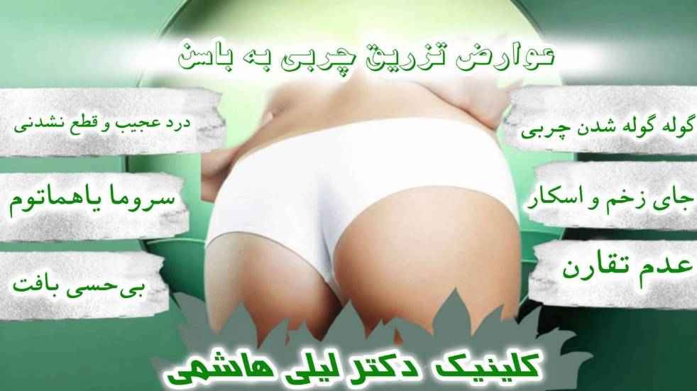 عوارض تزریق چربی به باسن شامل عدم تقارن، درد عجیب و بیحسی و... است.