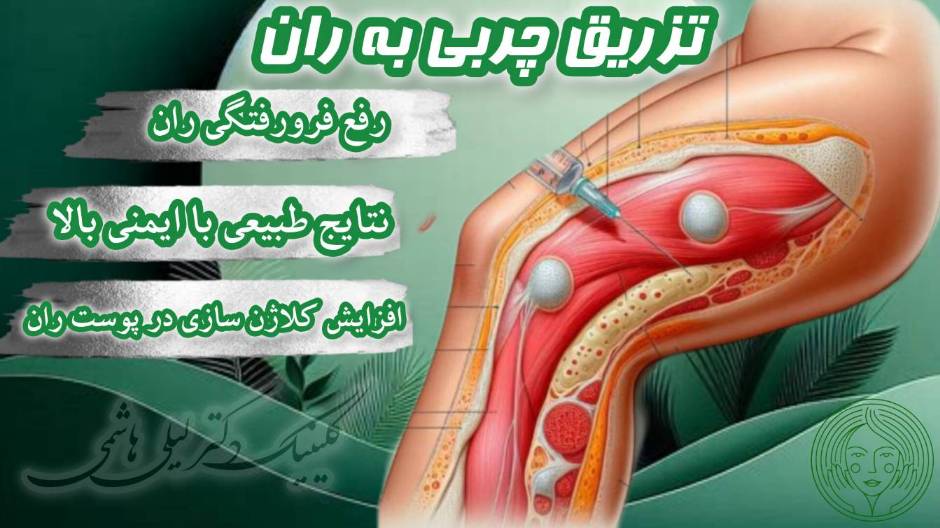 تزریق چربی به ران پا برای از بین رفتن لاغری و فرورفتگیهای ران