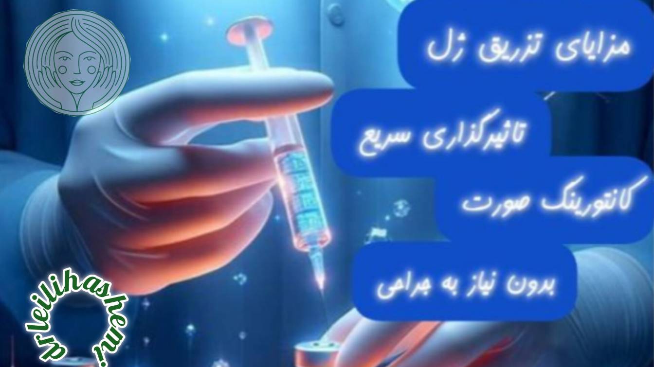 مزایای تزریق ژل چیست