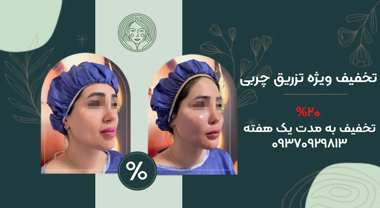 تخفیف تزریق چربی در تهران