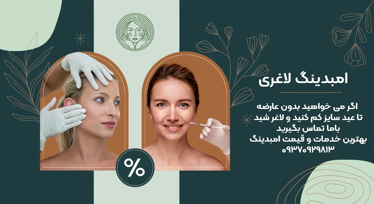 امبدینگ لاغری