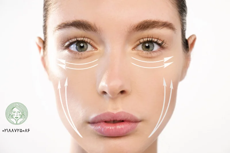 نخ کلاژن جذبی چیست؟