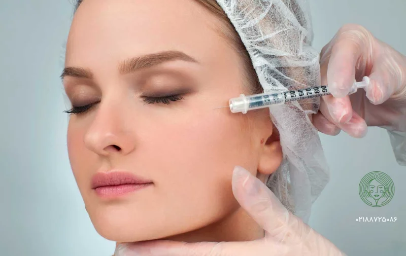 پروفایلو چیست