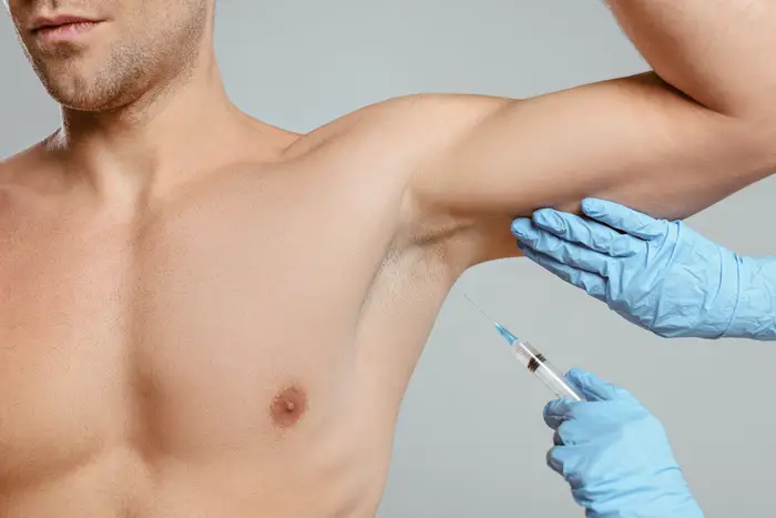 مزایای بوتاکس زیر بغل و درمان تعریق زیاد