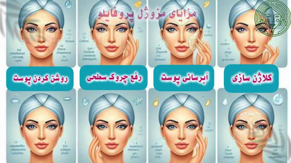 مزایای مزو ژل پروفایلو چی هستند؟