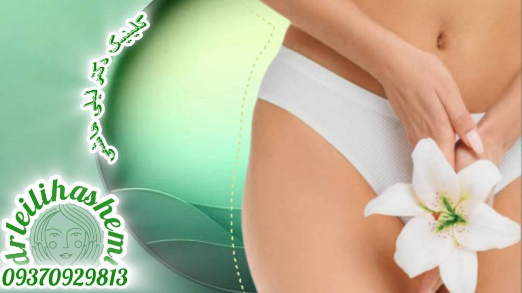 تزریق چربی به لابیا