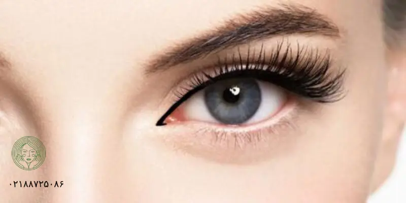 بوتاکس چشم گربه ای