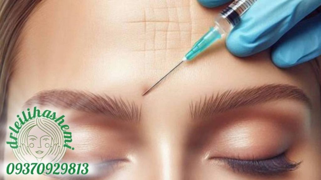 عوارض بوتاکس پیشانی