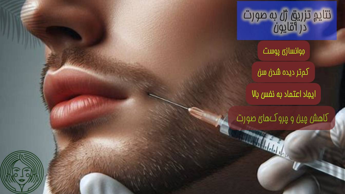 تزریق ژل به صورت آقایون چه مزایایی دارد؟