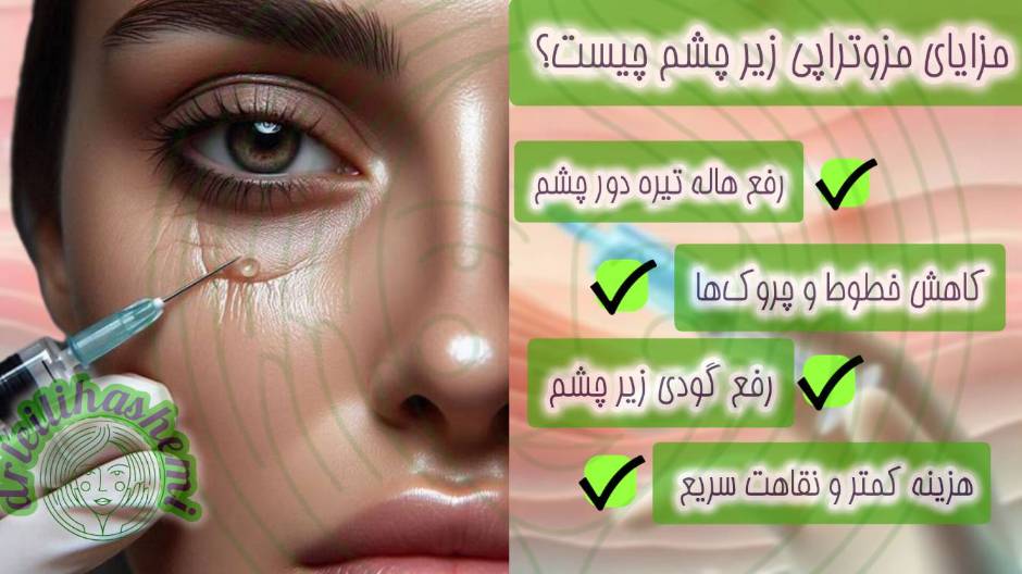 مزوتراپی زیر چشم 