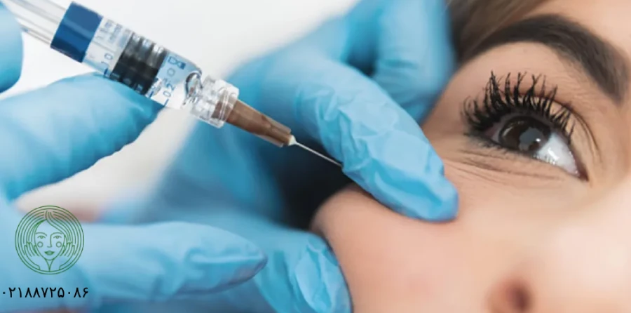 تزریق ژل گونه| بررسی انواع ژل گونه (هزینه و ماندگاری)