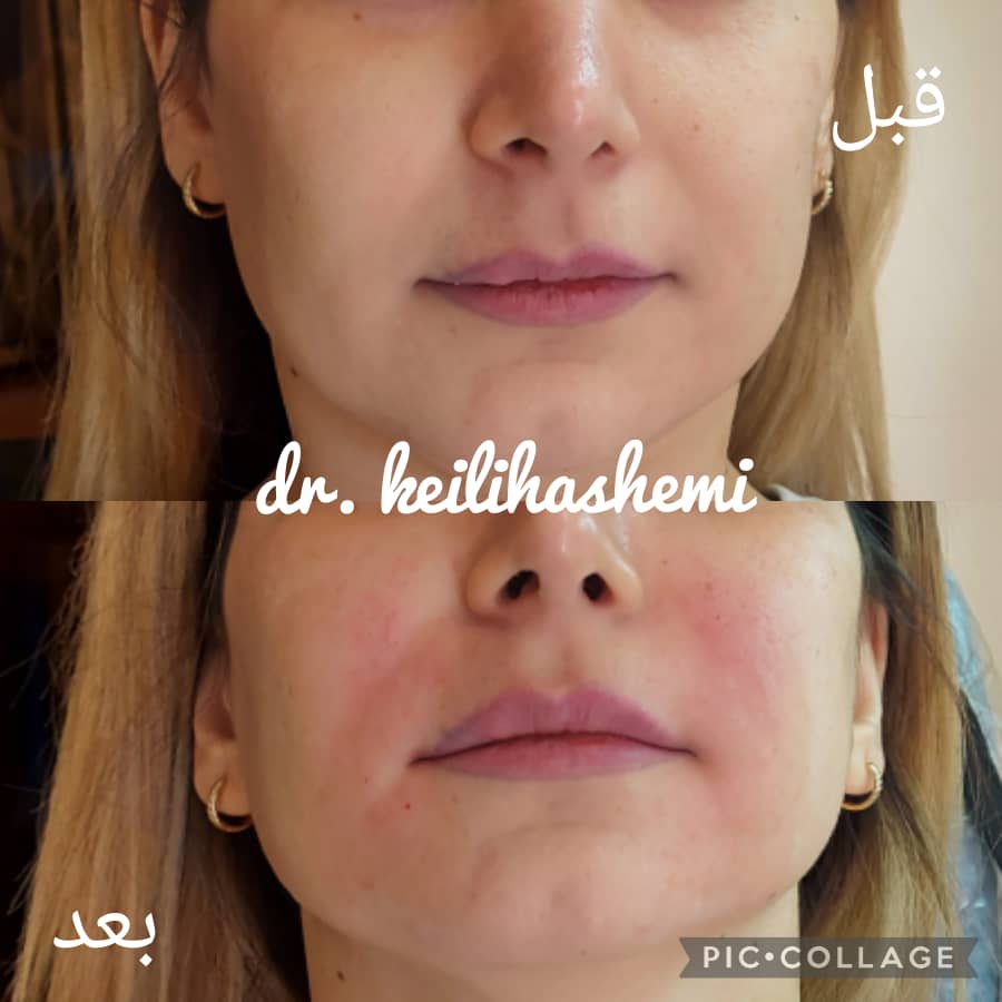 PHOTO-2025-03-05-11-04-47 3