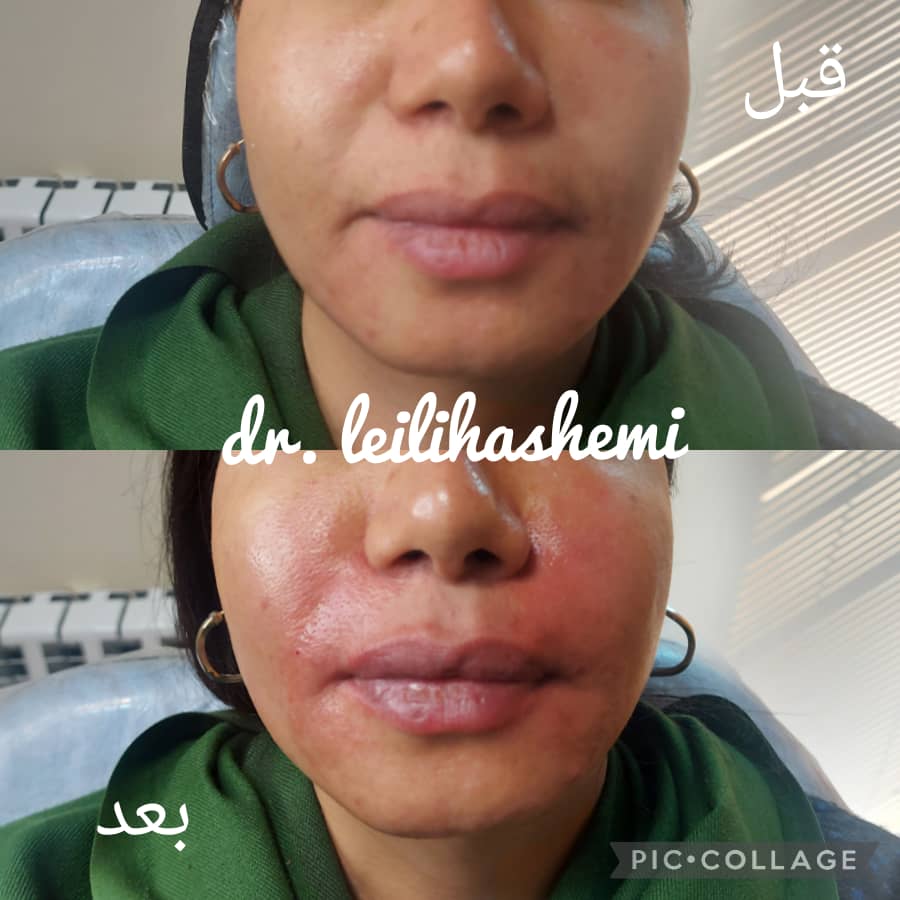 PHOTO-2025-03-05-11-04-48 3