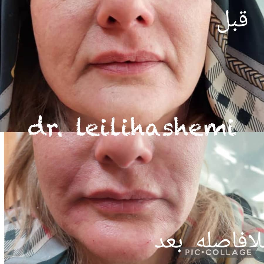 PHOTO-2025-03-05-11-04-50 2