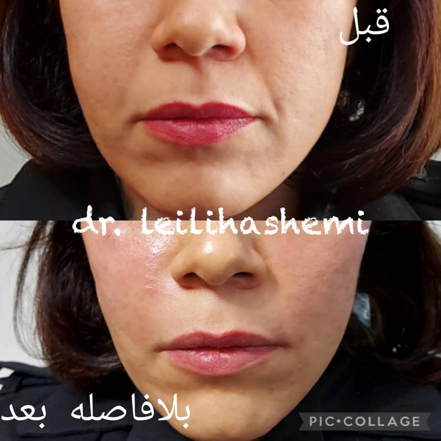 PHOTO-2025-03-05-11-04-51