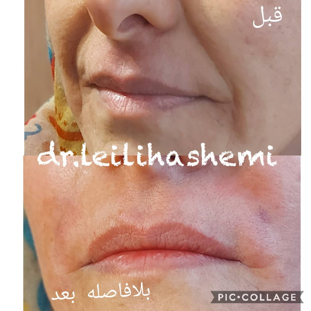 PHOTO-2025-03-05-11-04-52 2