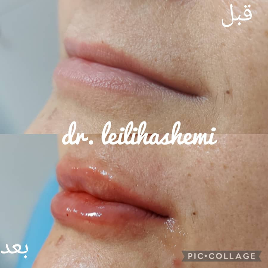 PHOTO-2025-03-05-11-05-28 2