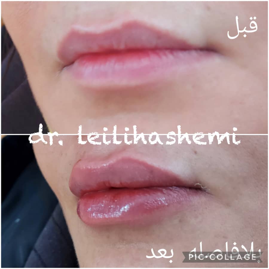 PHOTO-2025-03-05-11-05-33 3