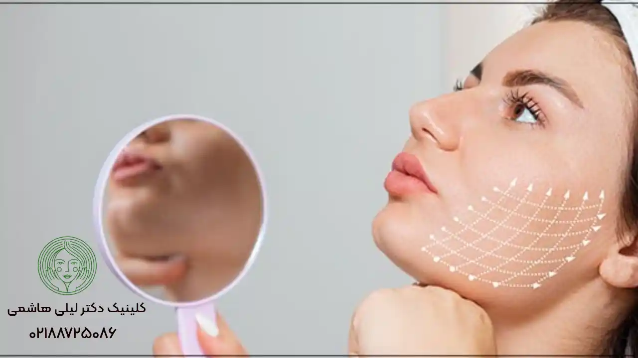 چرا برای لیفت نخ در تهران به کلینیک زیبایی دکتر لیلی هاشمی مراجعه کنیم؟