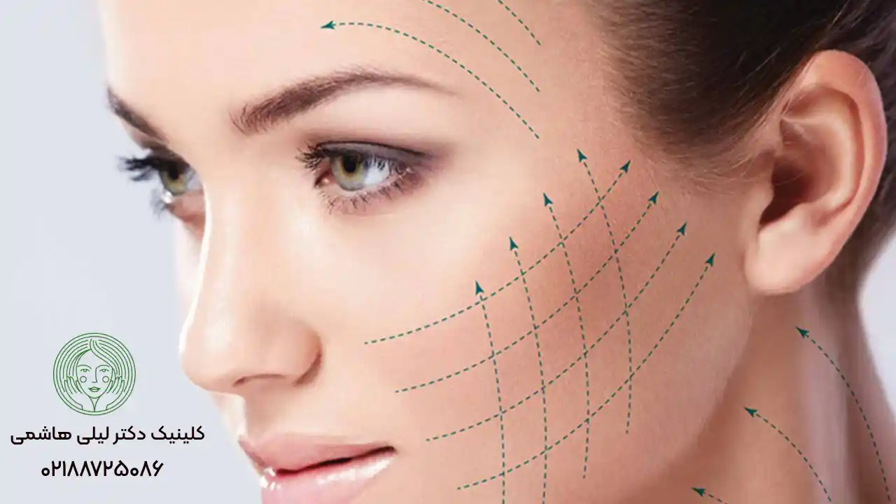 آیا لیفت صورت با نخ درد دارد؟