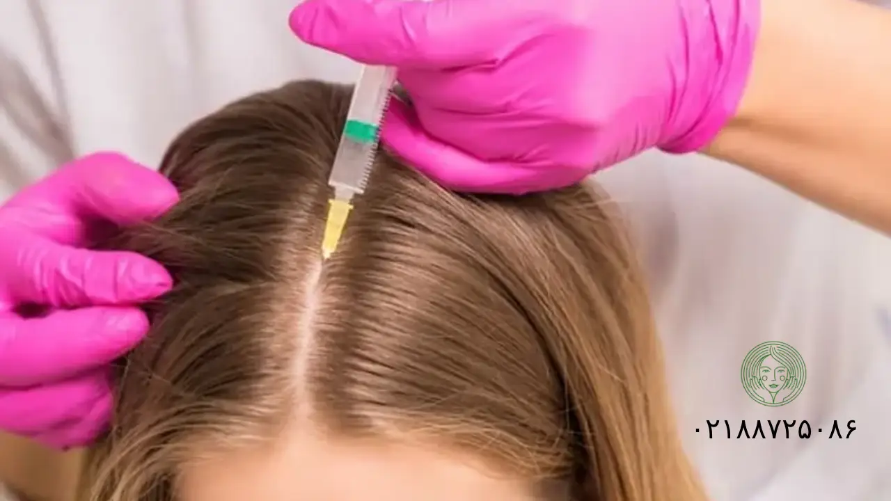 ماندگاری مزوتراپی مو