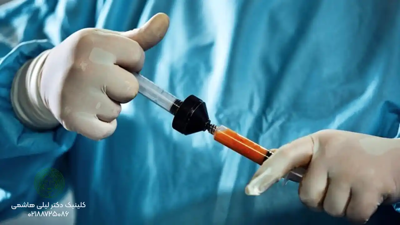 علت گلوله شدن چربی تزریق شده به صورت چیست؟