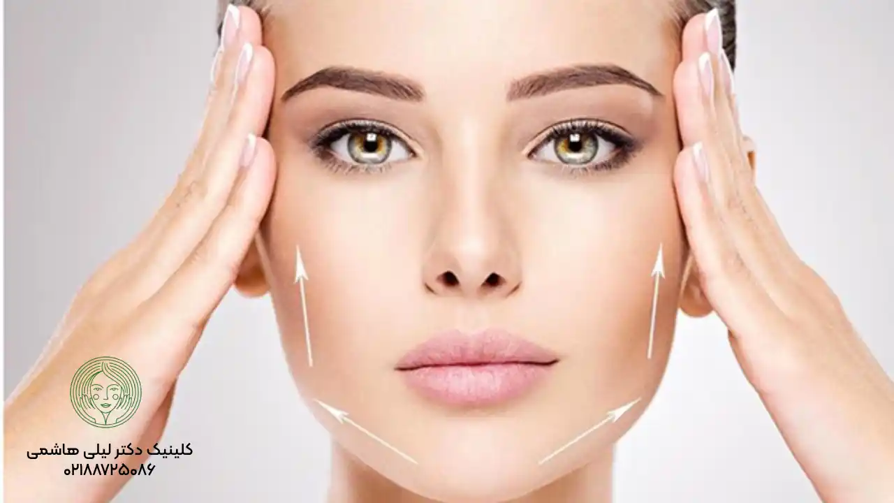 لیفت صورت با نخ بدون بیهوشی چگونه است؟