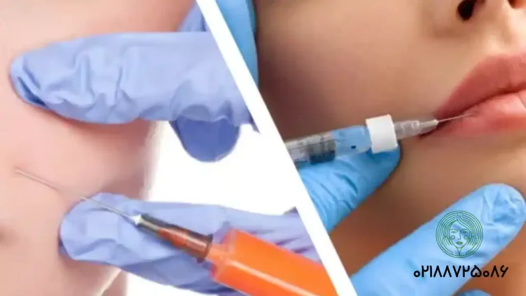 تزریق ژل بهتر است یا چربی؟ +مزایا و معایب آن