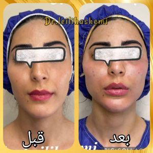 آب رسانی و مراقبت از پوست