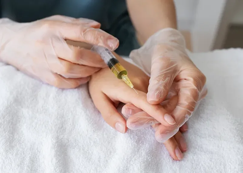 تفاوت تزریق چربی دست با فیلر