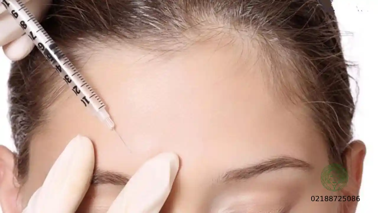 تزریق بوتاکس در تهران