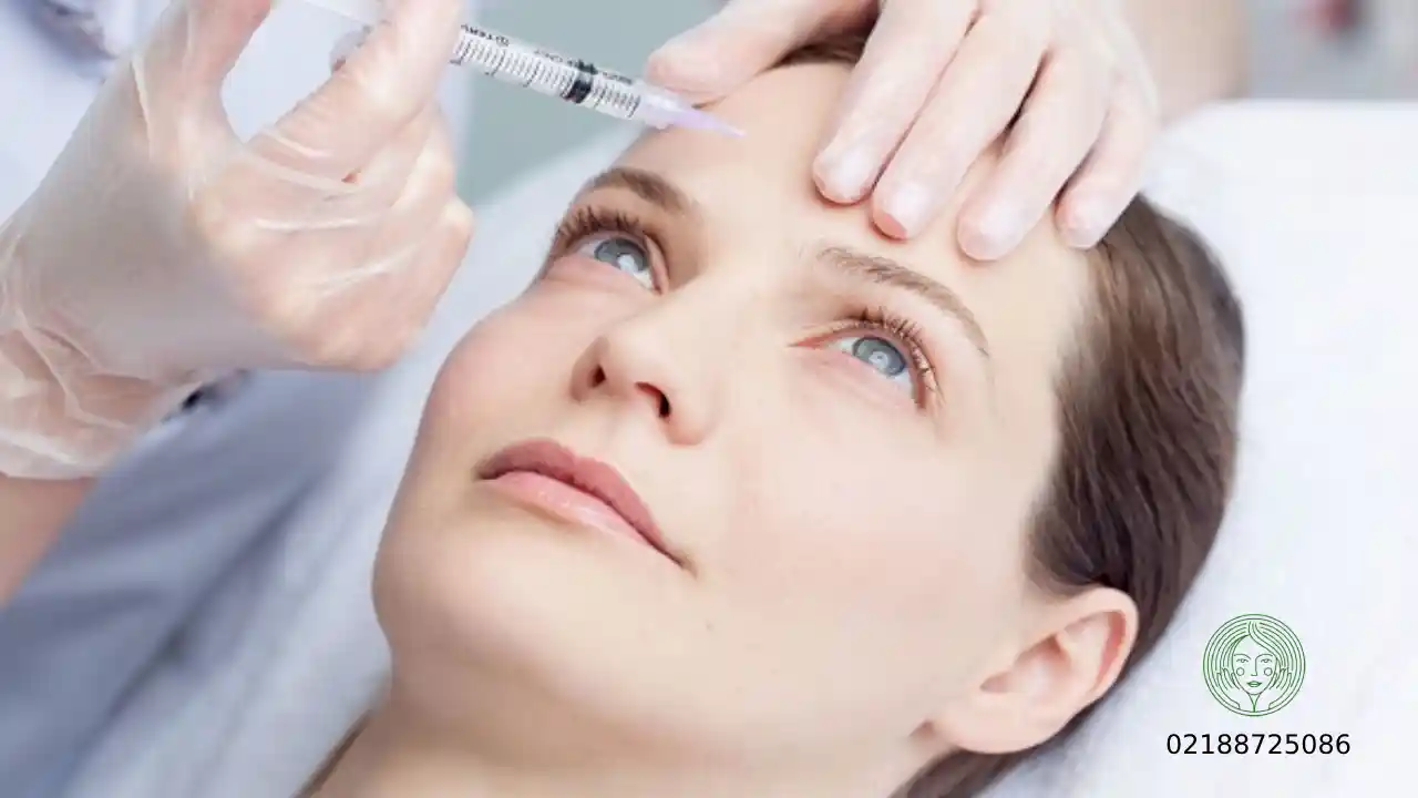 محل تزریق بوتاکس در صورت