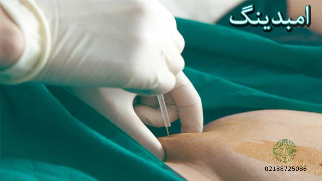 تفاوت لاغری با امبدینگ و طب سوزنی