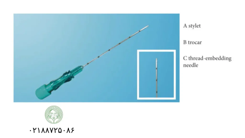 هزینه هر جلسه امبدینگ ۱۴۰۳