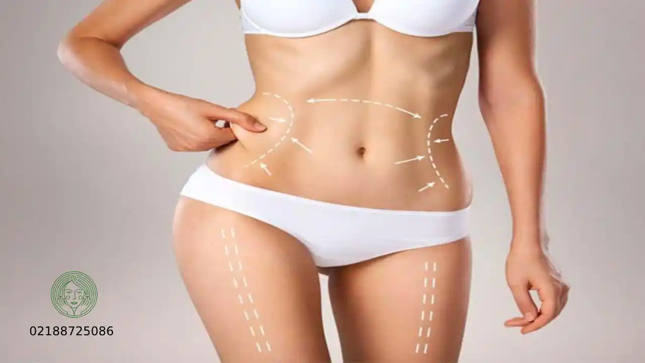 با امبدینگ تا چند کیلو می توان لاغر شد؟