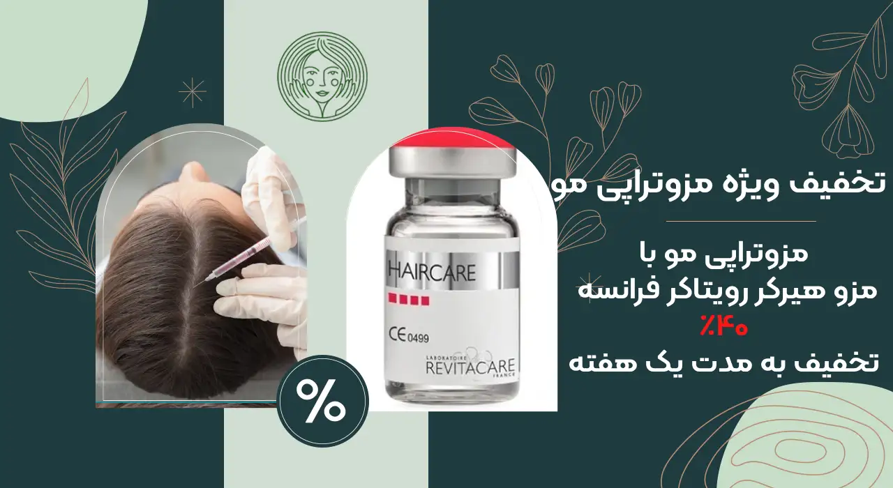 تخفیف مزوتراپی مو