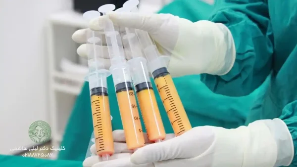 ماندگاری تزریق چربی صورت چقدر است؟ عوامل موثر + نکات ماندگاری بیشتر