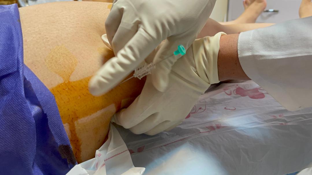 امبدینگ ران و ساق پا