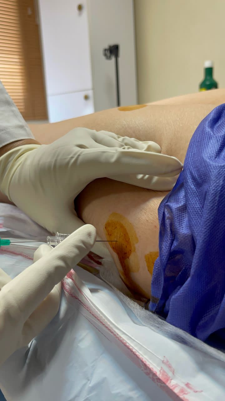 مراحل انجام امبدینگ ران پا و ساق پا به چه صورت است؟