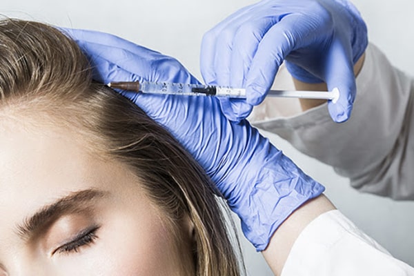 تعریفی از پی آر پی و مزوتراپی مو