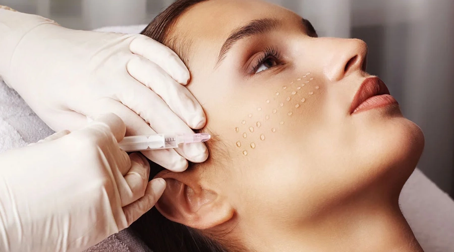 مزوتراپی صورت چیست؟