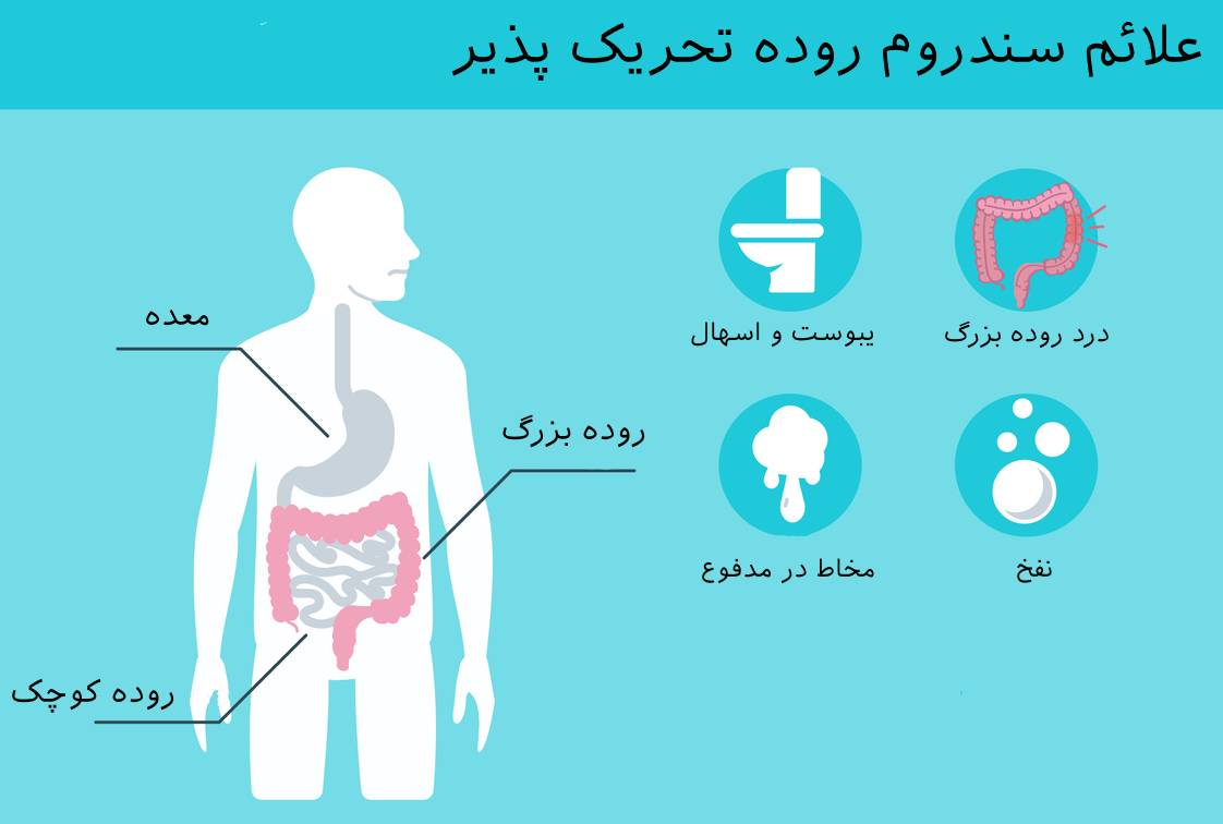 سندرم روده تحریک پذیر چیست؟