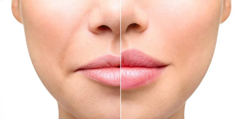 علت زود جذب شدن ژل لب