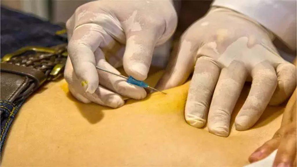 اثر نخ مخصوص امبدینگ برای چاقی های موضعی یا سلولیت